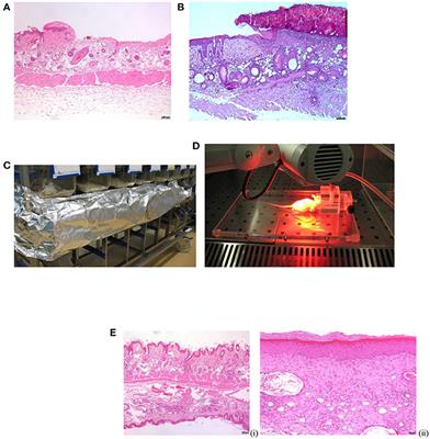 Comparison of Antibacterial Activity and Wound Healing in a Superficial Abrasion Mouse Model of Staphylococcus aureus Skin Infection Using Photodynamic Therapy Based on Methylene Blue or Mupirocin or Both